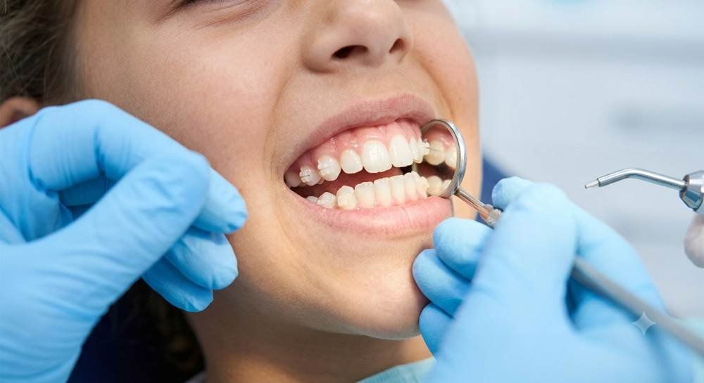 Patient dental checkup